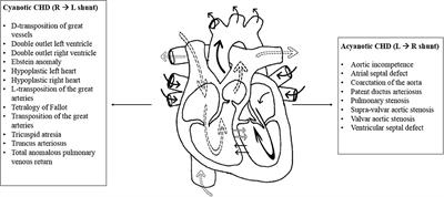 COVID-19 in Pediatric Patients: A Focus on CHD Patients